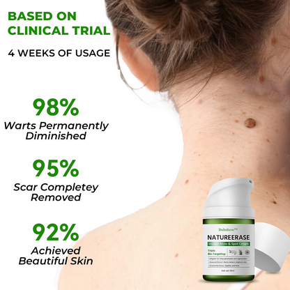 ✅ Official store: Dobshow™ NatureErase Instant Mole & Spot Cream