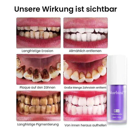 Nurbini™ Rein pflanzliches Zahnweiß-Mousse