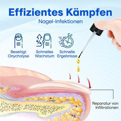 Nurbini™ OnyxoGuard Serum für Nagelwachstum und -reparatur💅