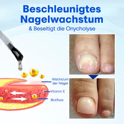 Nurbini™ OnyxoGuard Serum für Nagelwachstum und -reparatur💅