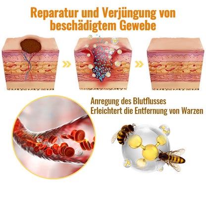 ✨🐝Dobshow™ Bienengift Hautperfektionsspray: Natürliches Entfernen von Hautmarken & Warzen🐝🌿🐝