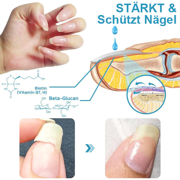 Nurbini™ OnycholysisHeal: Nagelstärkendes und Wachstumsreparatur-Essenz 💅✨