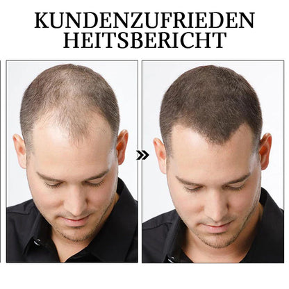 Dobshow™ Kräuter-Haarstärkungsserum