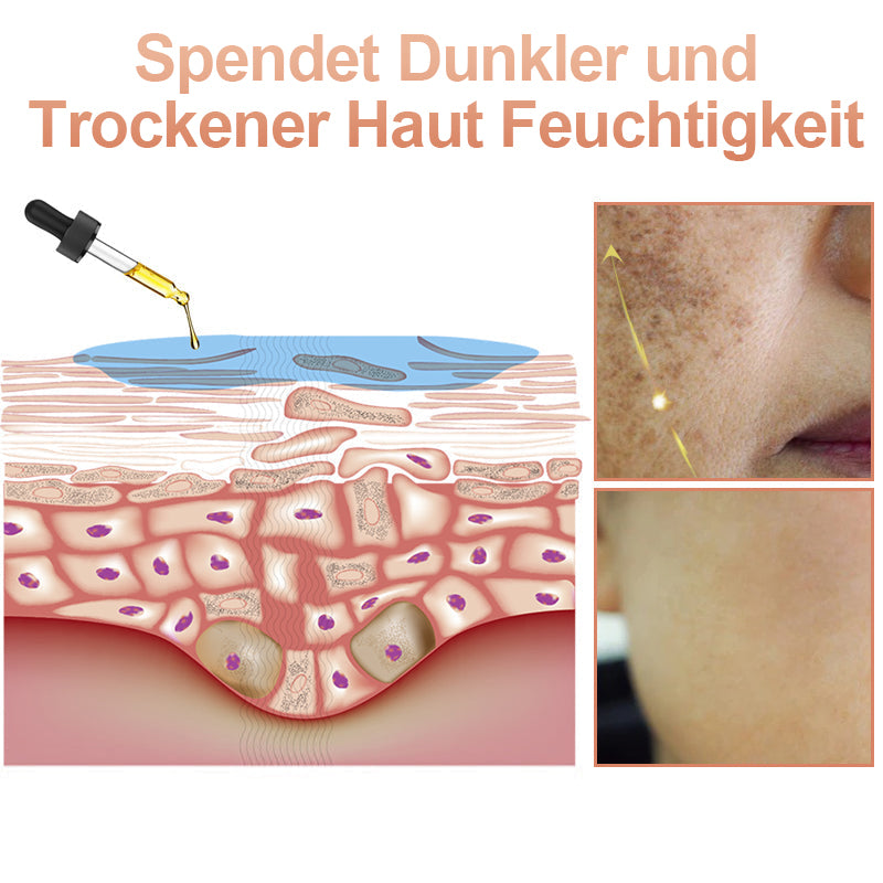 ✨🤩Schnelle Dunkle Flecken Entferner- Dobshow™ Melanin-korrigierendes Gesichtsserum💫