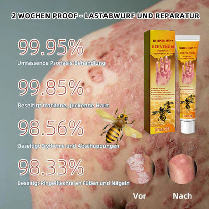 Dobshow™ Bienengift-Psoriasis-Behandlungscreme (Für alle Hautzustände geeignet)