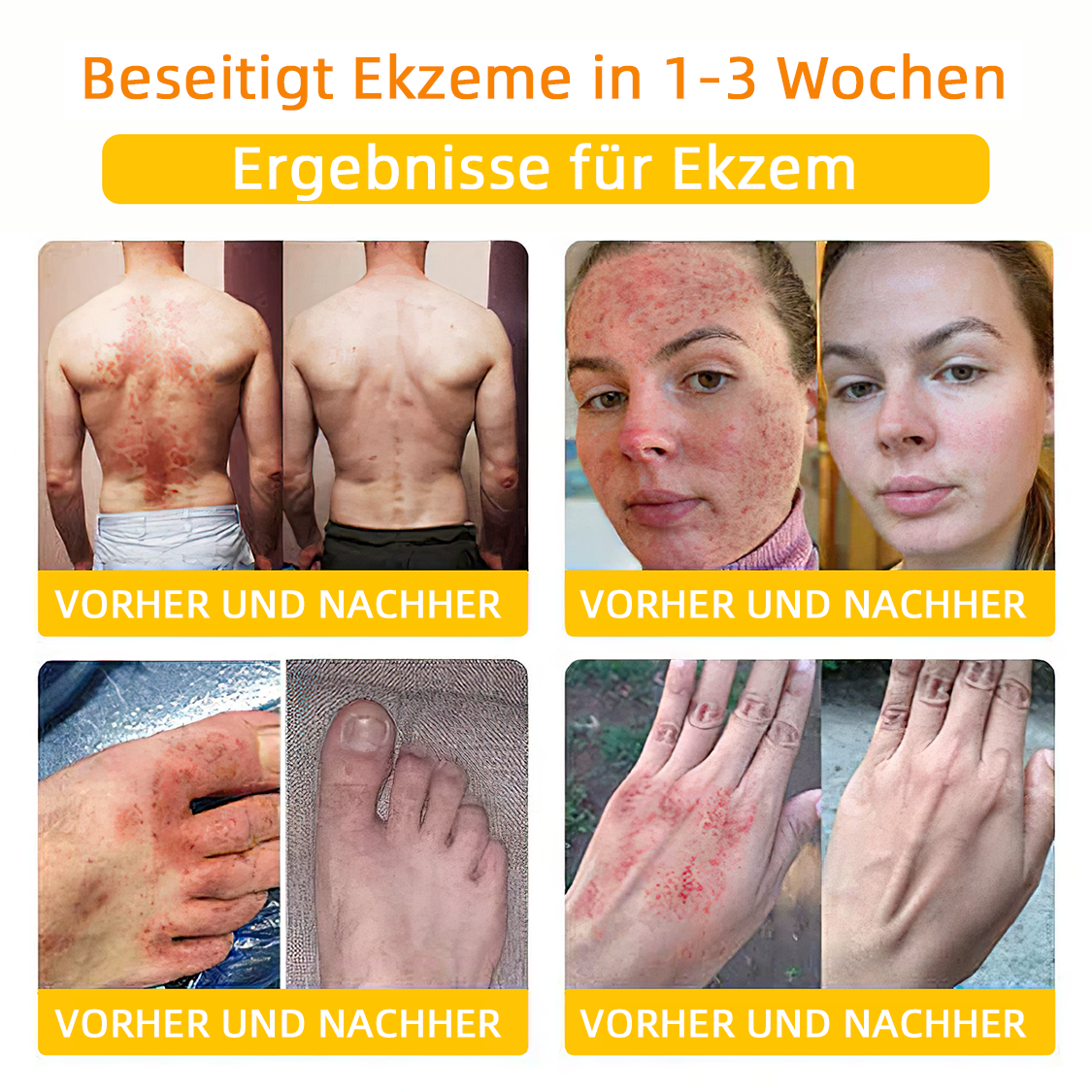 💎Turonu™ Bienengift Hautpflegecreme（ BfArM Deutschland）💎