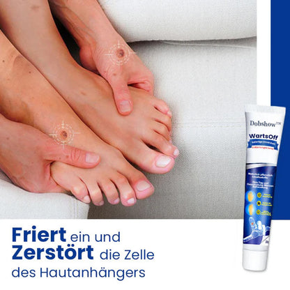 Dobshow™ WartsOff Rapid Creme zur sofortigen Entfernung von Hautunreinheiten
