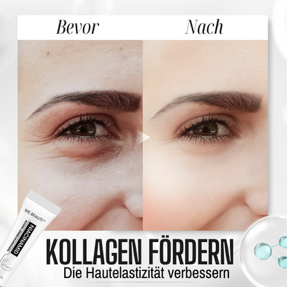 WE.Beauti™  Niacinamid Augenerwachen Gel