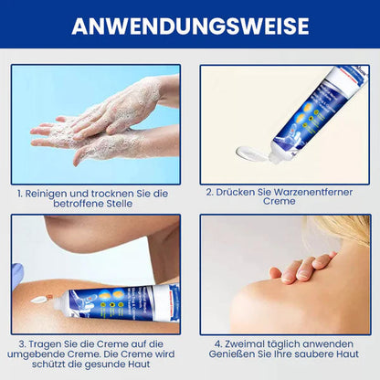 Dobshow™ WartsOff Rapid Creme zur sofortigen Entfernung von Hautunreinheiten