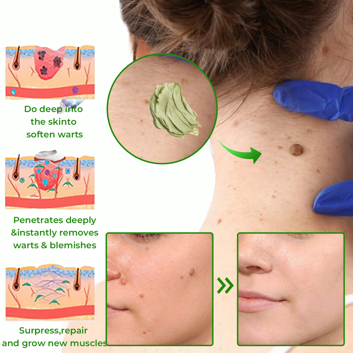 ✅ Official store: Dobshow™ NatureErase Instant Mole & Spot Cream