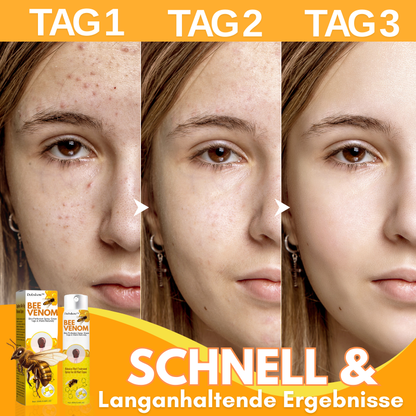Dobshow™ Bienengift Hautperfektionsspray✨💛