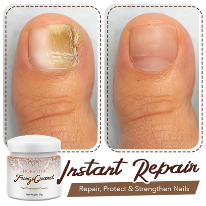 Dobshow™ FungiGuard Nagelbehandlungscreme
