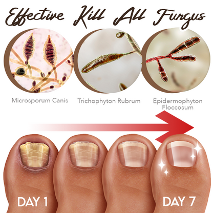 Dobshow™ FungiGuard Nagelbehandlungscreme