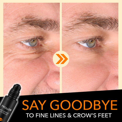 Froller™ Age Defense Augenroller