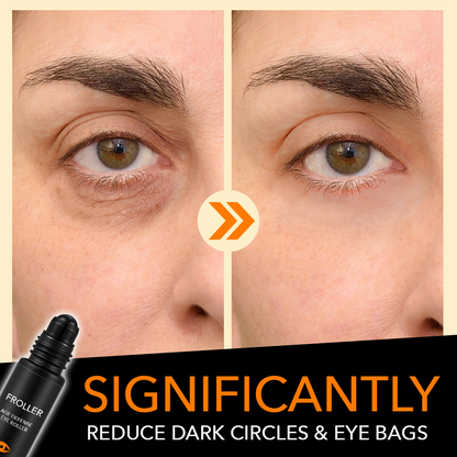 Froller™ Age Defense Augenroller