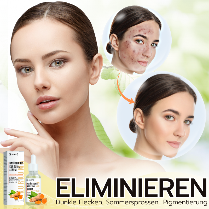 WE.Beauti™ Kurkuma Naturserum