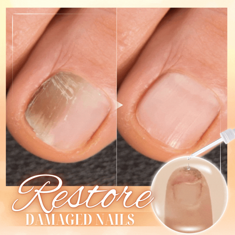 Dobshow™ Serum für Nagelwachstum und -stärkung
