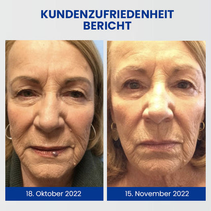 Dobshow™ WartsOff Rapid Creme zur sofortigen Entfernung von Hautunreinheiten