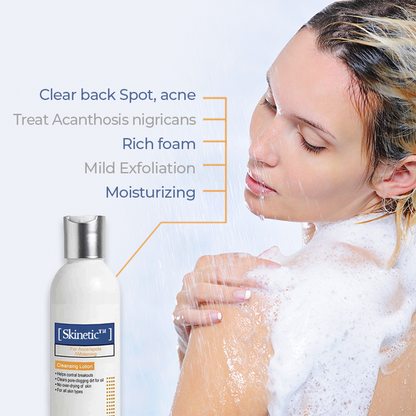 Skinetic™ Reinigungslotion für Akne & Akanthose Nigricans