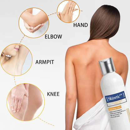 Skinetic™ Reinigungslotion für Akne & Akanthose Nigricans
